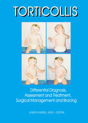 Torticollis: Differential Diagnosis, Assessment and Treatment, Surgical Management and Bracing book cover