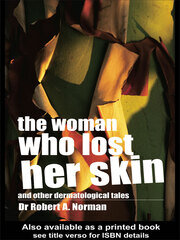 The Woman Who Lost Her Skin: (And Other Dermatological Tales) book cover