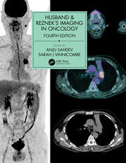 Husband & Reznek's Imaging in Oncology book cover
