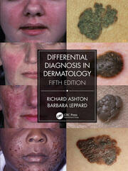 Differential Diagnosis in Dermatology book cover