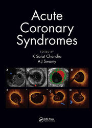 Acute Coronary Syndromes book cover
