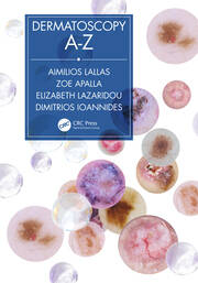 Dermatoscopy A-Z book cover
