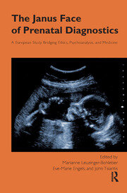 The Janus Face of Prenatal Diagnostics: A European Study Bridging Ethics, Psychoanalysis, and Medicine book cover