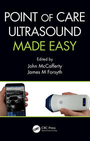 Point of Care Ultrasound Made Easy book cover