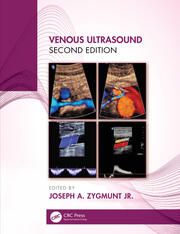 Venous Ultrasound book cover