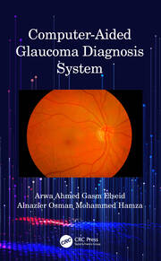 Computer-Aided Glaucoma Diagnosis System book cover