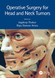 Operative Surgery for Head and Neck Tumors book cover