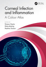 Corneal Infection and Inflammation: A Colour Atlas book cover