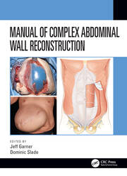 Manual of Complex Abdominal Wall Reconstruction book cover