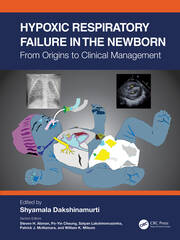 Hypoxic Respiratory Failure in the Newborn: From Origins to Clinical Management book cover