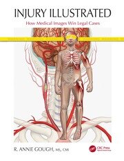 Injury Illustrated: How Medical Images Win Legal Cases book cover