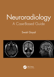 Neuroradiology: A Case-Based Guide book cover