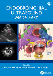 Endobronchial Ultrasound Made Easy book cover