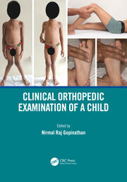 Clinical Orthopedic Examination of a Child book cover