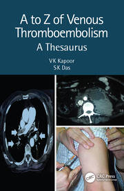 A to Z of Venous Thromboembolism: A Thesaurus book cover