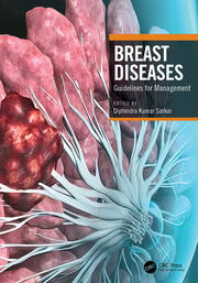 Breast Diseases: Guidelines for Management book cover