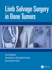 Limb Salvage Surgery in Bone Tumors book cover