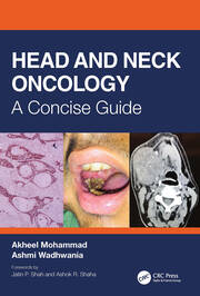 Head and Neck Oncology: A Concise Guide book cover