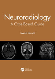 Neuroradiology: A Case-Based Guide book cover