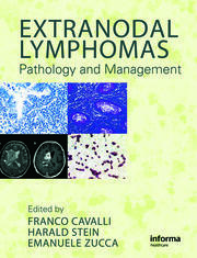 Extranodal Lymphomas: Pathology and Management book cover