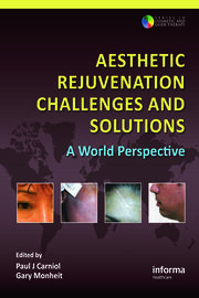 Aesthetic Rejuvenation Challenges and Solutions: A World Perspective book cover