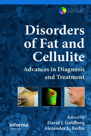 Disorders of Fat and Cellulite: Advances in Diagnosis and Treatment book cover