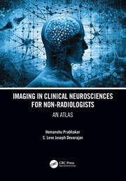 Imaging in Clinical Neurosciences for Non-radiologists: An Atlas book cover