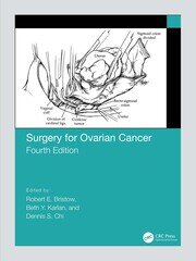 Surgery for Ovarian Cancer book cover