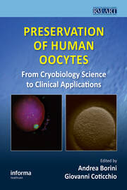 Preservation of Human Oocytes: From Cryobiology Science to Clinical Applications book cover