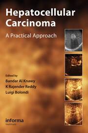 Hepatocellular Carcinoma: A Practical Approach book cover