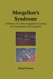 Morgellon's Syndrome book cover