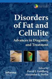 Disorders of Fat and Cellulite: Advances in Diagnosis and Treatment book cover