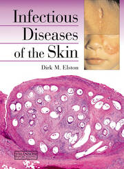 Infectious Diseases of the Skin book cover