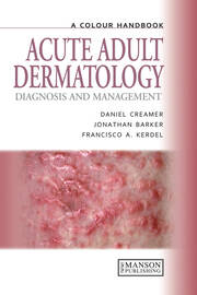 Acute Adult Dermatology: Diagnosis and Management: A Colour Handbook book cover