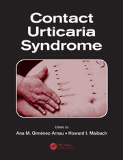 Contact Urticaria Syndrome book cover