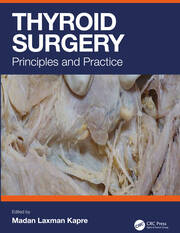 Thyroid Surgery: Principles and Practice book cover