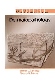 Dermatopathology book cover