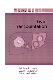 Liver Transplantation book cover