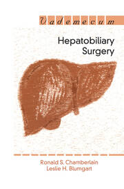 Hepatobiliary Surgery book cover