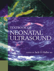 Textbook of Neonatal Ultrasound book cover