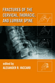 Fractures of the Cervical, Thoracic, and Lumbar Spine book cover