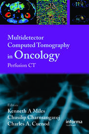Multi-Detector Computed Tomography in Oncology: CT Perfusion Imaging book cover