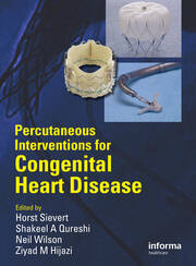 Percutaneous Interventions for Congenital Heart Disease book cover