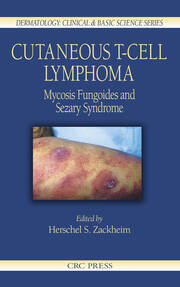 Cutaneous T-Cell Lymphoma: Mycosis Fungoides and Sezary Syndrome book cover