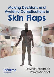 Making Decisions and Avoiding Complications in Skin Flaps book cover