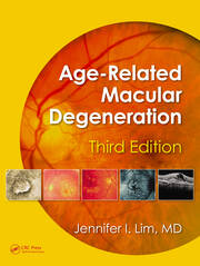 Age-Related Macular Degeneration, Third Edition book cover