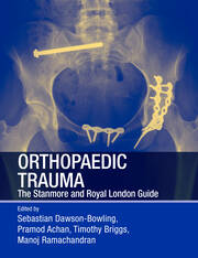 Orthopaedic Trauma: The Stanmore and Royal London Guide book cover