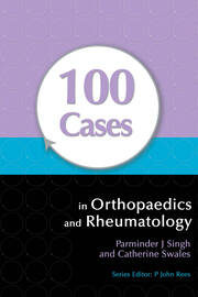 100 Cases in Orthopaedics and Rheumatology book cover