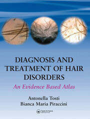Diagnosis and Treatment of Hair Disorders: An Evidence-Based Atlas book cover