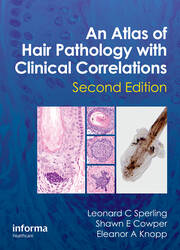 An Atlas of Hair Pathology with Clinical Correlations book cover